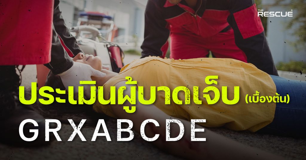หลักประเมินผู้บาดเจ็บเบื้องต้น G-R-X-A-B-C-D-E